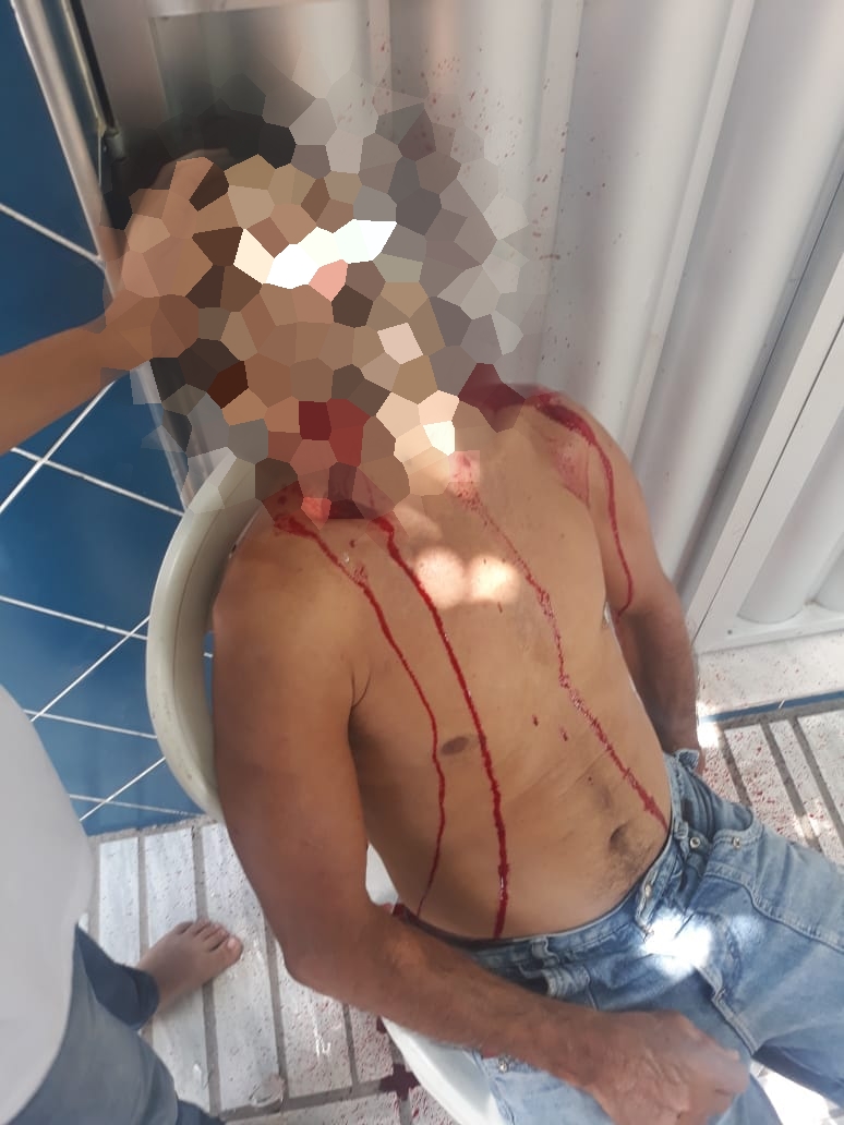 Homem é executado a bala em Quixadá na calçada de casa, no Bairro Campo Velho