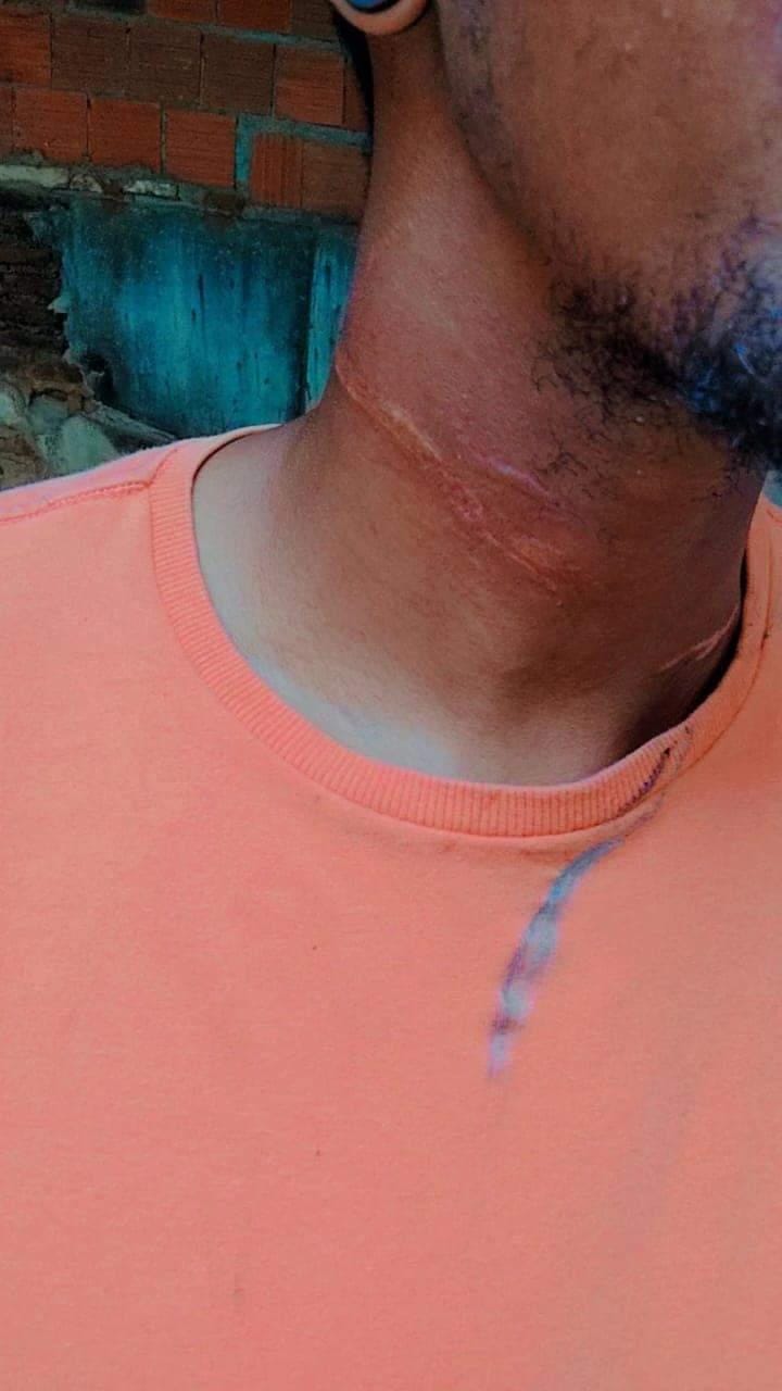 Casal fica ferido após colidir com fios de internet soltos na rua em Quixadá