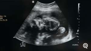 MP investiga rede clandestina de abortos em Fortaleza após denúncia chocante: gestante teria sido dopada e bebê retirado