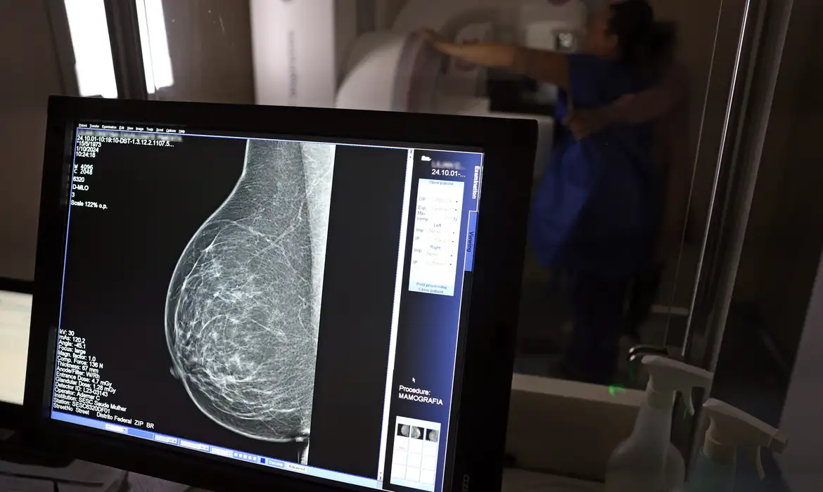 Planos de saúde deverão cobrir mamografia digital sem limite de idade a partir de outubro